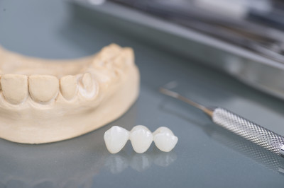 Dental gypsum models in dental laboratory