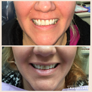 Linden Dental Before/After