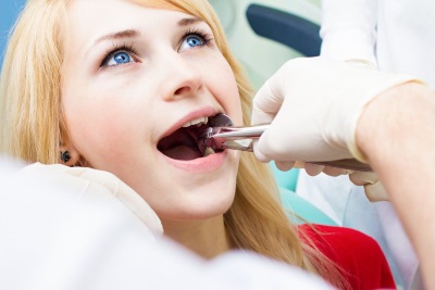 Oral Surgery Extraction