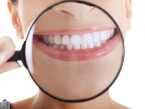 Cosmetic Dentistry Zoom Whitening